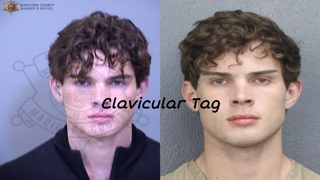 Clavicular Tag cover